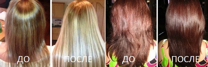 до и после до и после